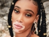 From being a contestant on America’s Next Top Model, to gracing the cover of many prestigious magazines, Canadian model Winnie Harlow has become one of the biggest names in fashion, having propelled her way to the top through her inner-confidence and self-worth | Photo By Max Papendieck